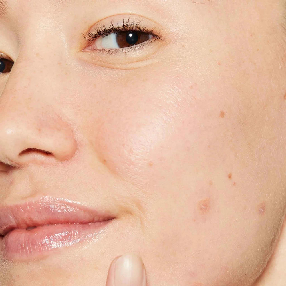 Close-up of a person's face with visible skin texture and pores.