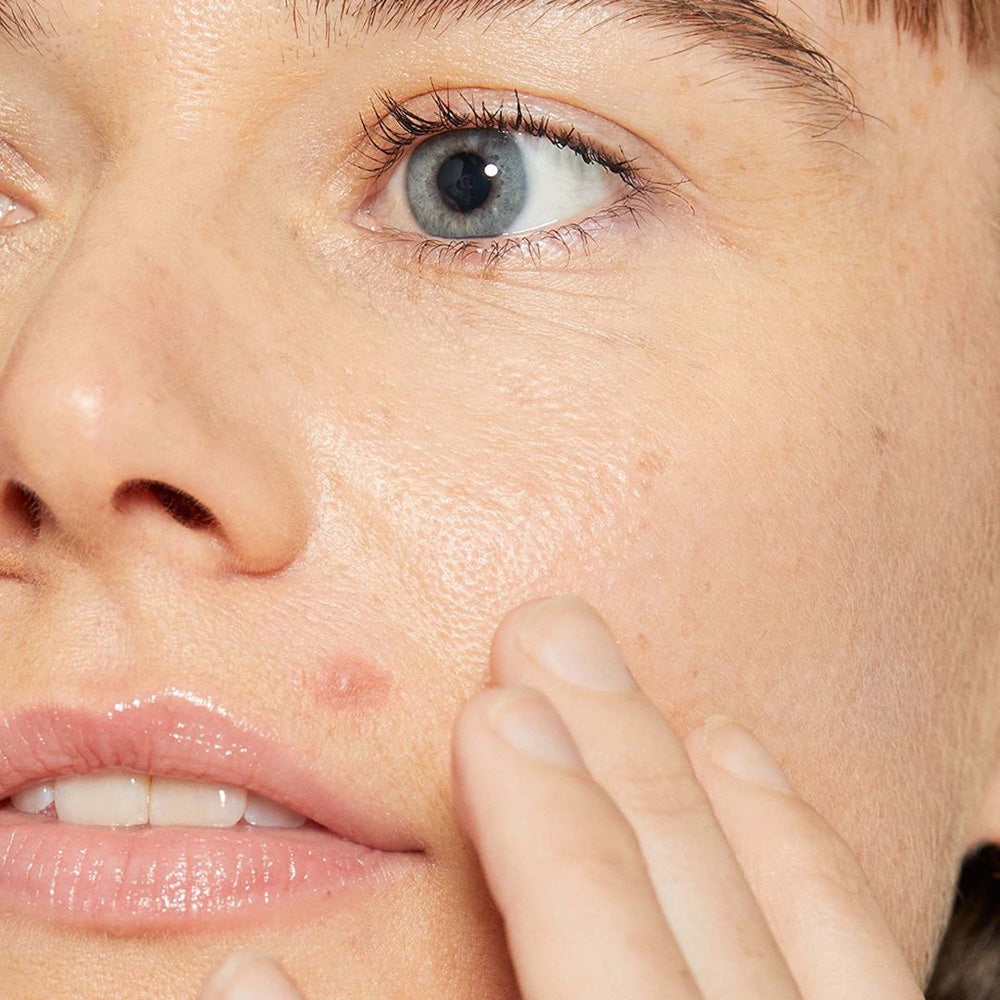 Close-up of a woman's face with a focus on her eye and skin texture.