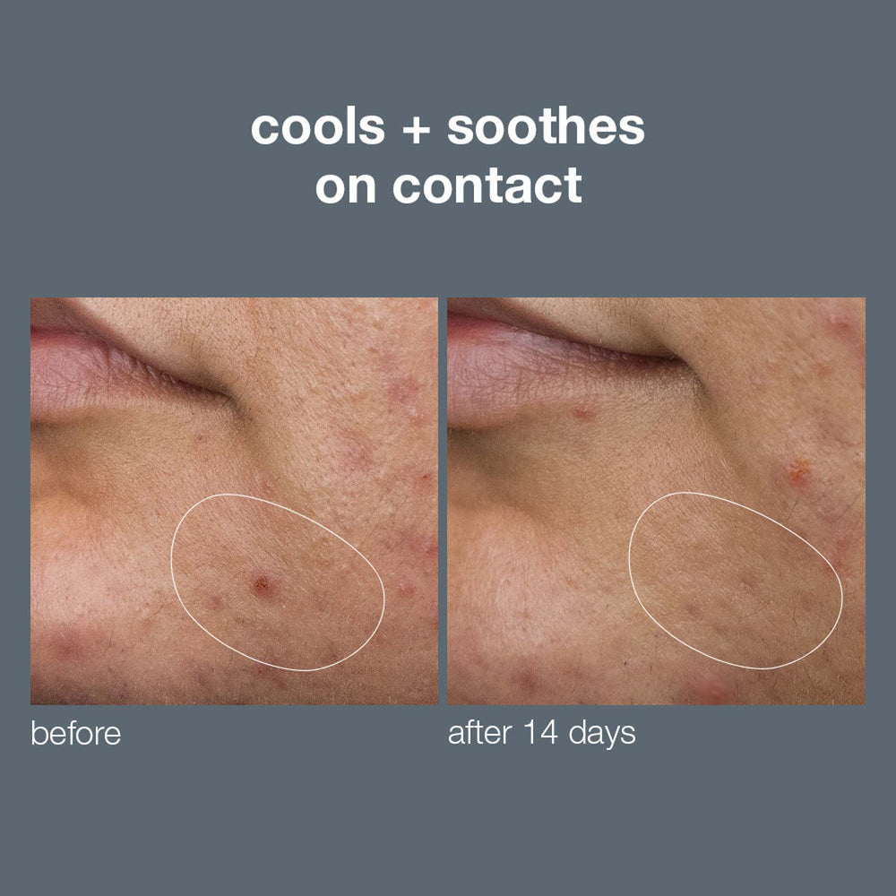 Before and after comparison of skin with a blemish on a gray background.